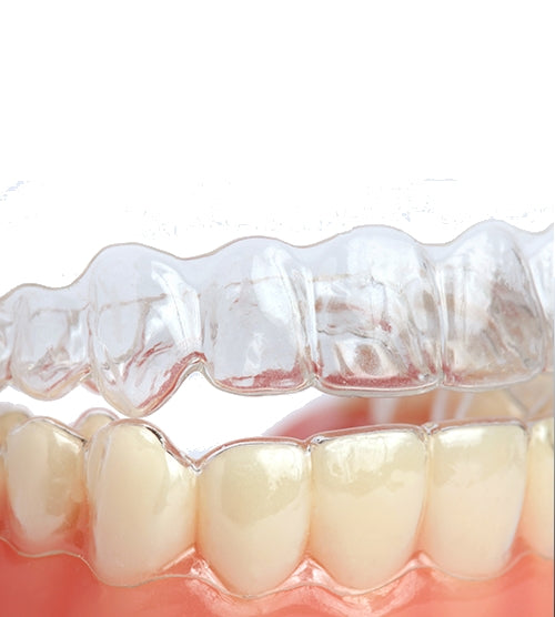 Mouth guard for clenching deals teeth